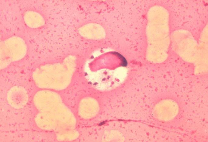 Leishmaniosis. [Imagen: Fundación IO]