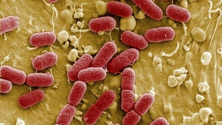 S.U.H., Esta bacteria, productora de toxina, causa el Síndrome urémico Hemolítico. [Imagen: Clarin]